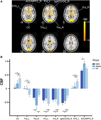 Cerebral Blood Flow Changes in Multiple Sclerosis and Neuromyelitis Optica and Their Correlations With Clinical Disability